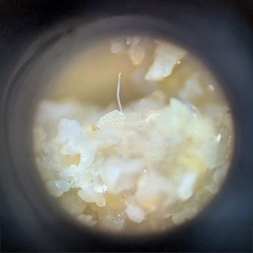 Foto einer Nematode im Binokular